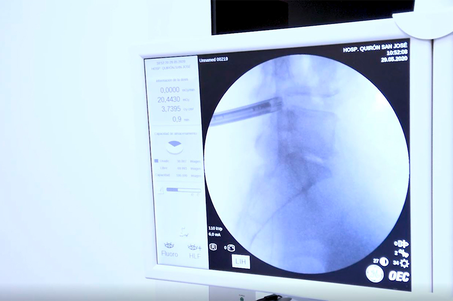 cirugia-hernia-discal