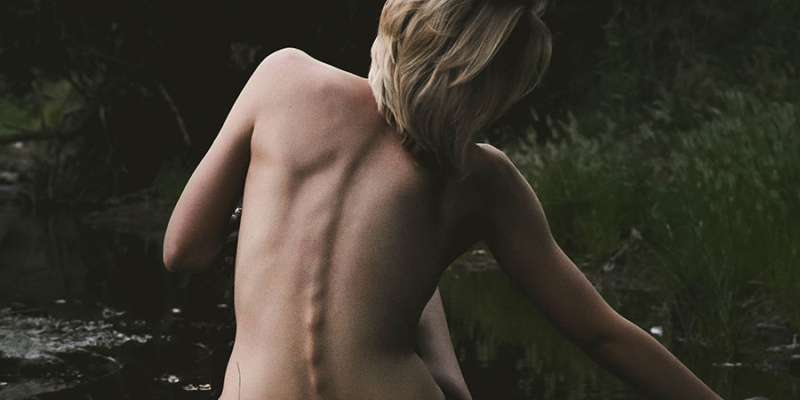 Diagnóstico y tratamiento de la espina bífida