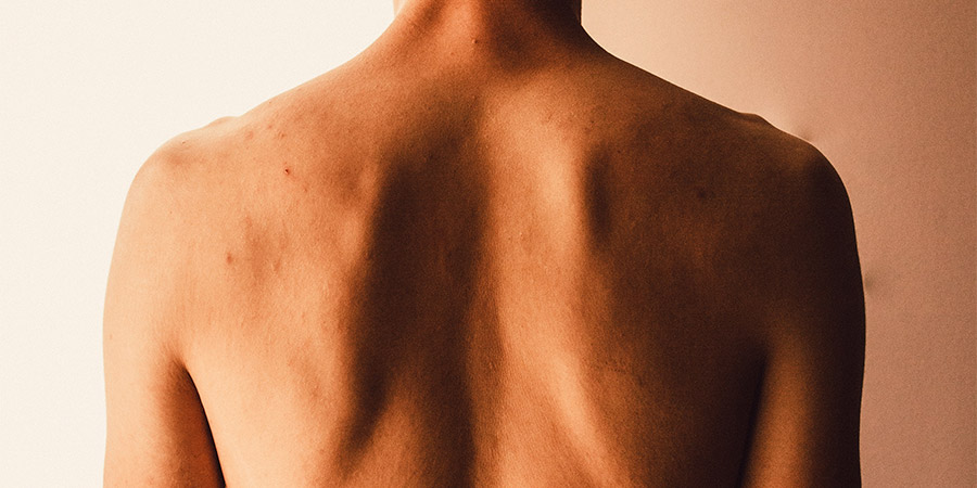 Higiene postural y hábitos saludables para cuidar de la espalda