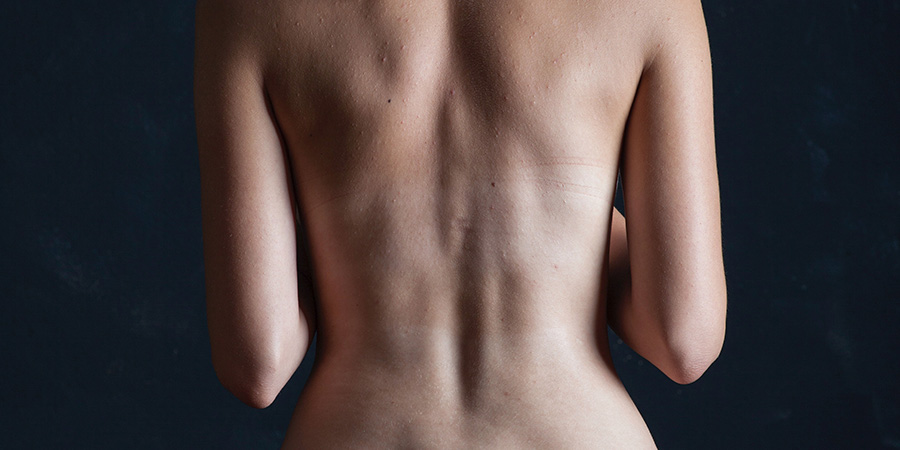 laminectomía operacion