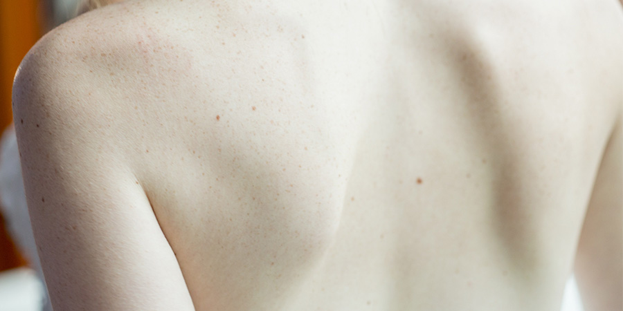 laminectomía riesgos