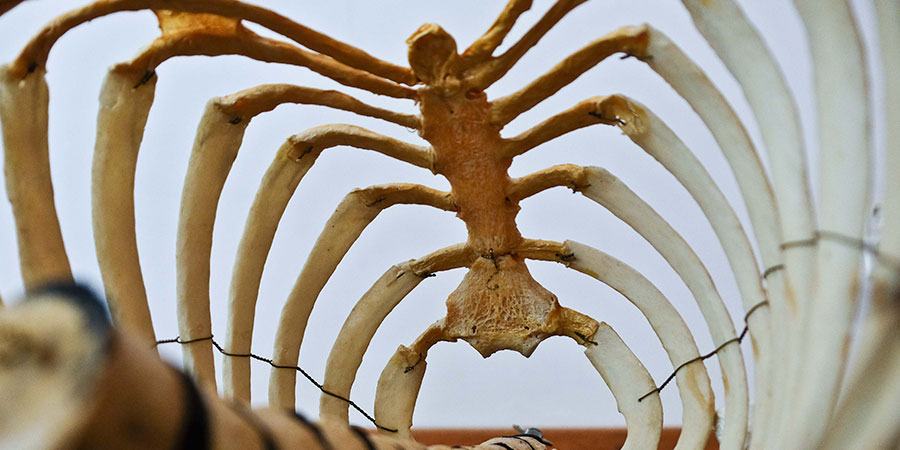 Qué es la espina bífida