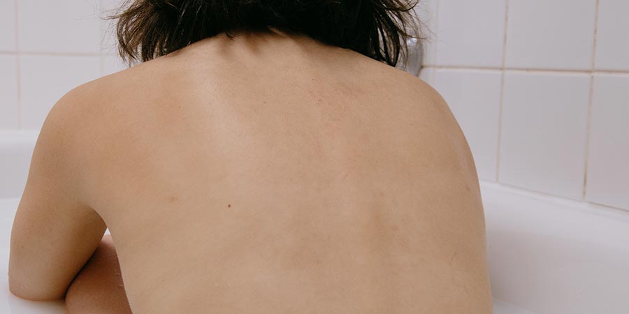 Qué es la espondilitis anquilosante