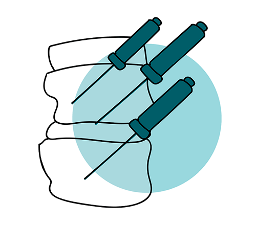 icono tratamiento columna radiofrecuencia